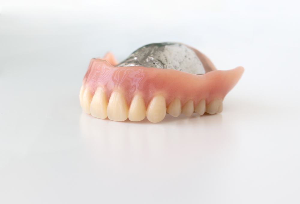 金属床義歯