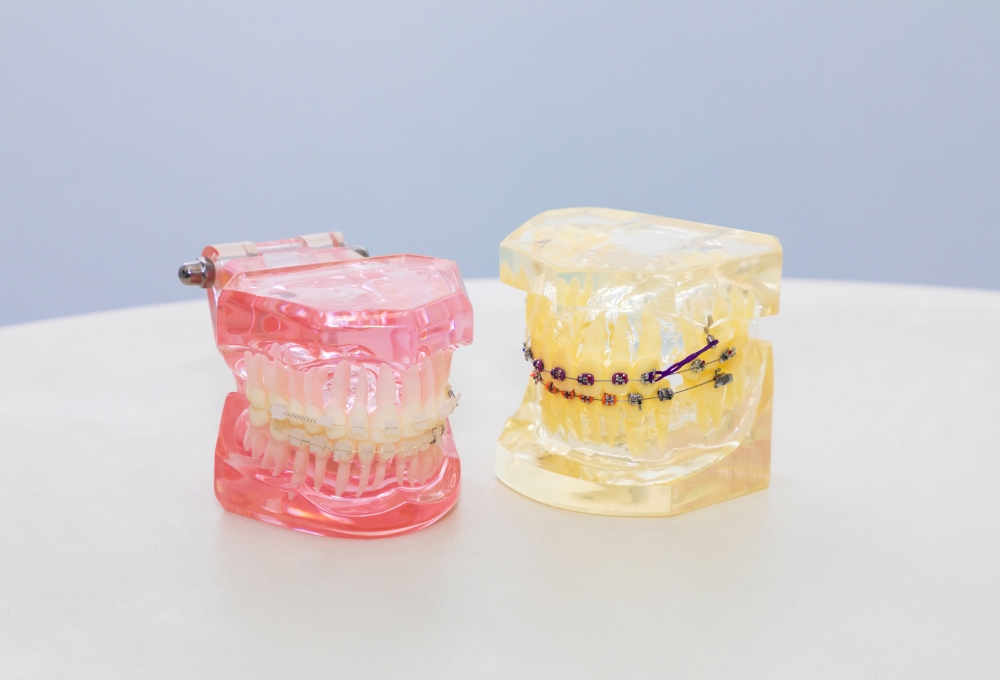 見た目と機能、どちらも整える矯正治療を