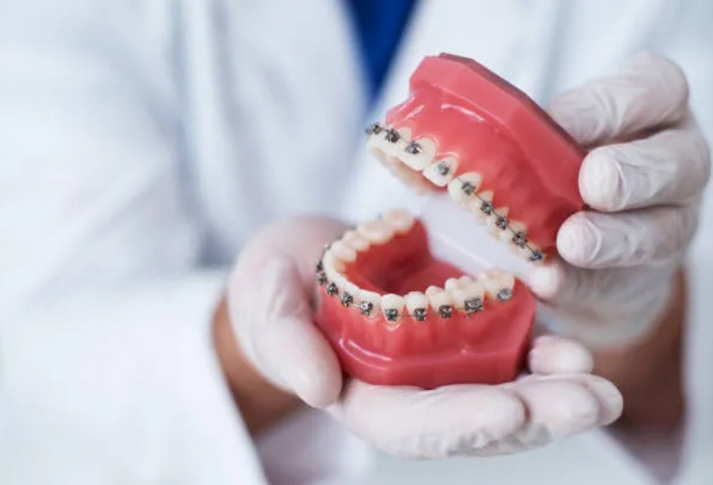 メタルブラケット