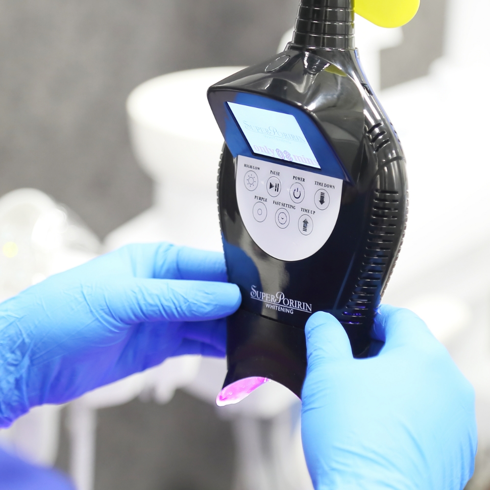 オフィスホワイトニング